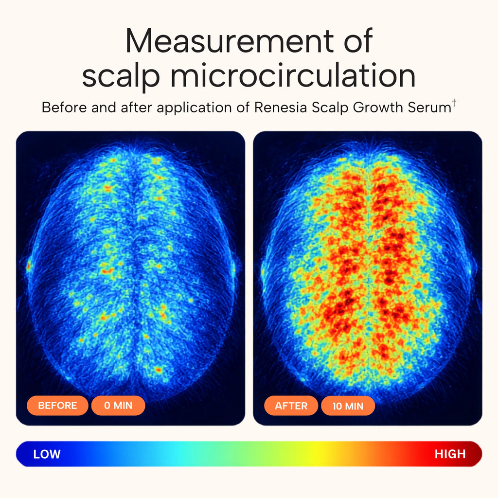 Scalp microcirculation before and after application