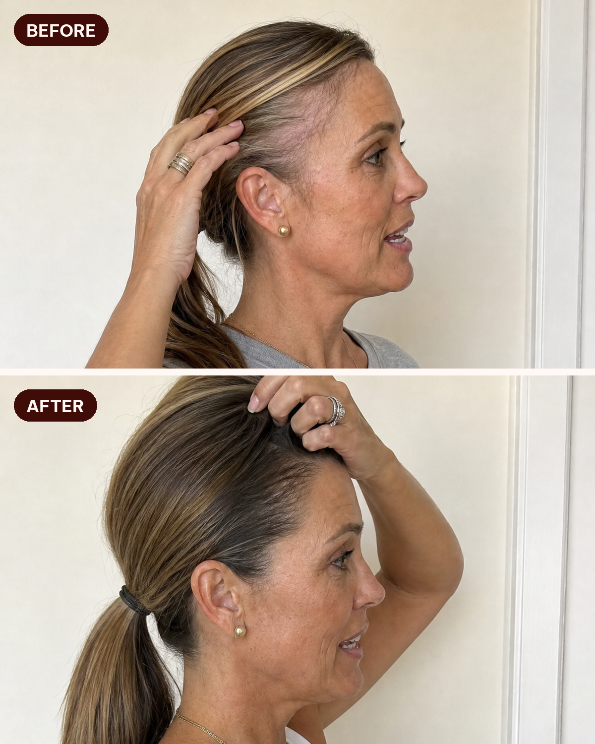 Hair density at the part and ponytail, before and after consistent use
